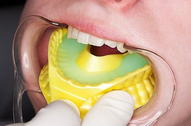 Dr. Anil's Dental & Implant Centre