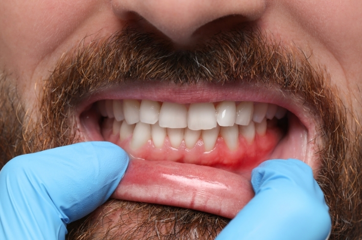 Dr. Anil's Dental & Implant Centre