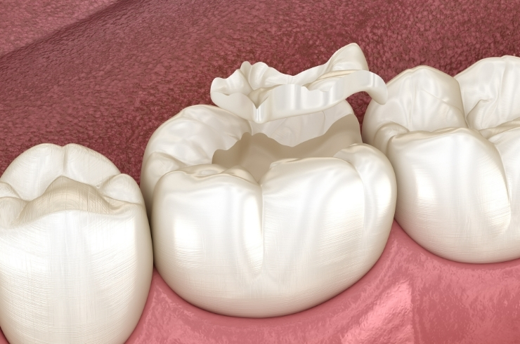 Dr. Anil's Dental & Implant Centre