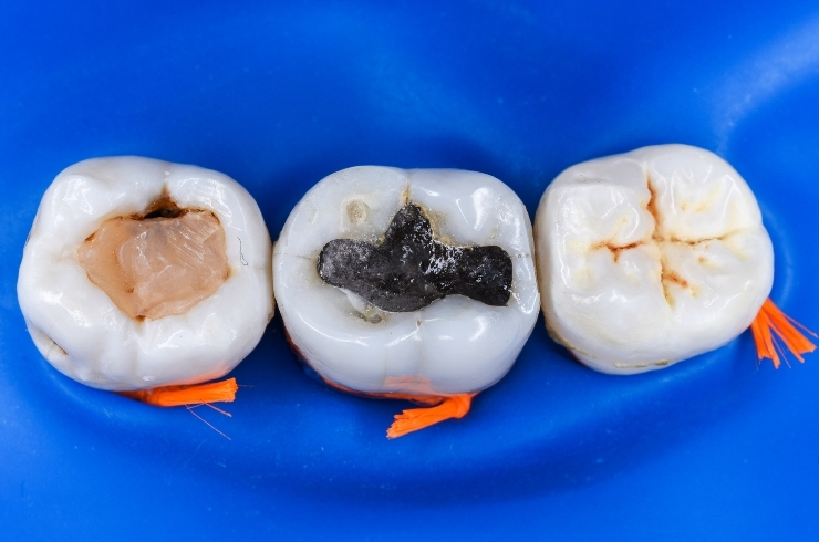 Dr. Anil's Dental & Implant Centre