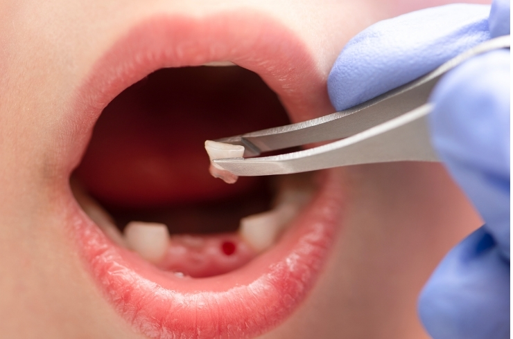 Dr. Anil's Dental & Implant Centre