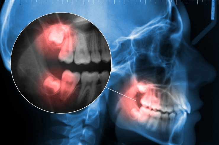 Dr. Anil's Dental & Implant Centre